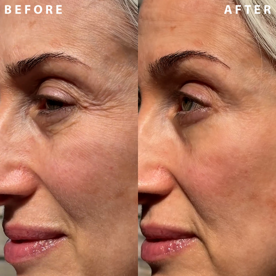 Perfect Instant Face Tightener